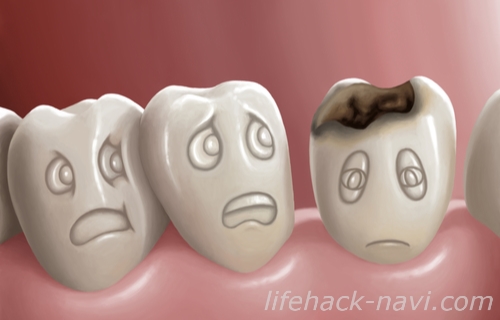 歯 黄色 原因 虫歯