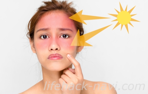 顎 吹き出物 原因 紫外線