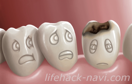 顎 吹き出物 原因 虫歯